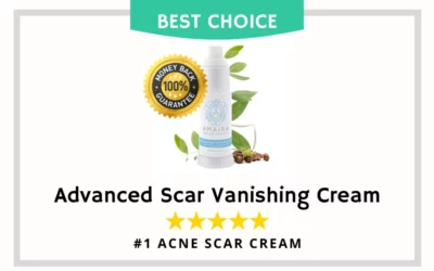 The Best Acne Scar Treatments in 2023